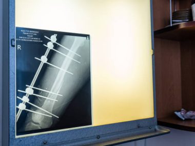 How Much Are X-Rays without Insurance